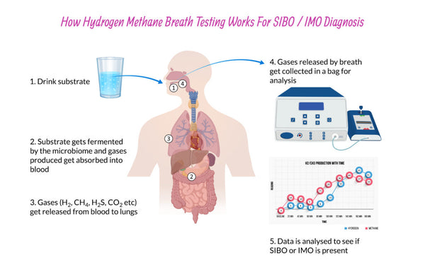 Small Intestinal Bacterial Overgrowth (SIBO) Test